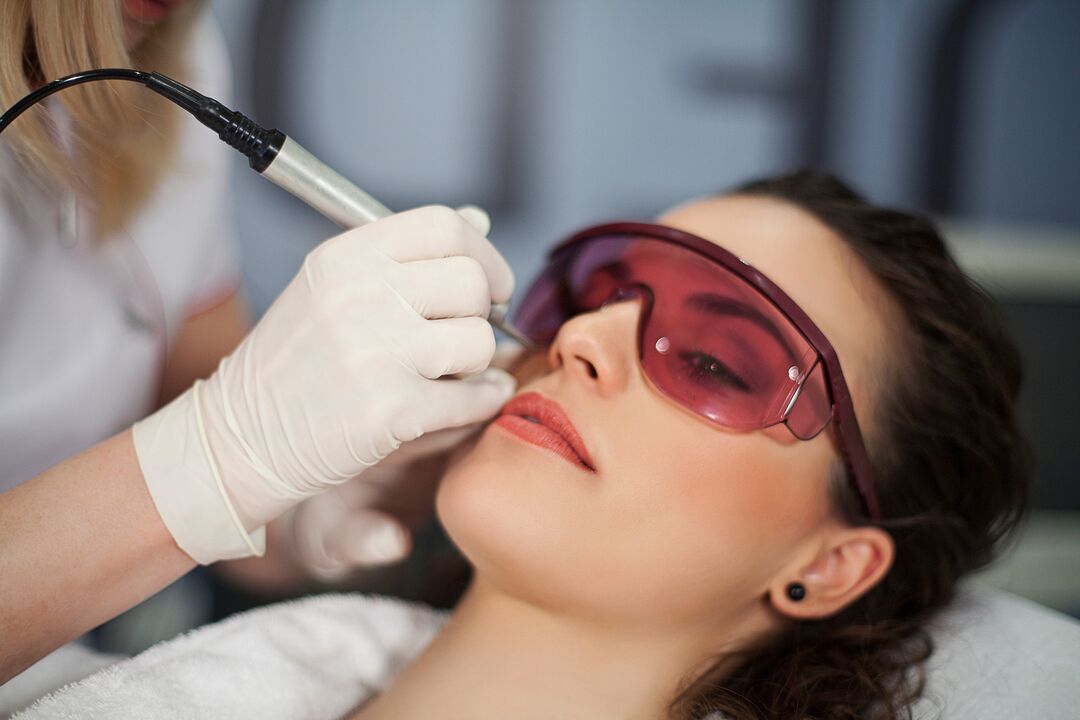 laser aphoresis for skin rejuvenation