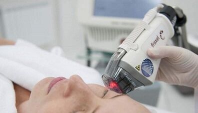 How fractional skin rejuvenation is done